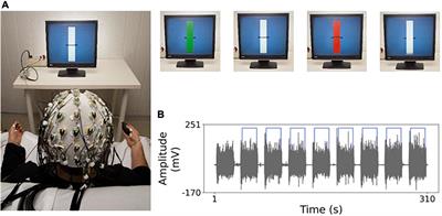 Normalized compression distance to measure cortico-muscular synchronization